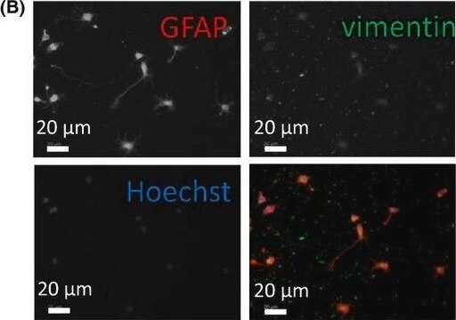 Anti-Vimentin antibody produced in rabbit affinity isolated antibody