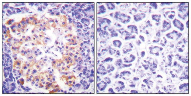 Anti-Collagen III antibody produced in rabbit affinity isolated antibody