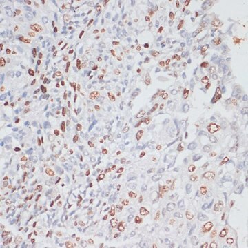 Anti-Ki67 antibody produced in rabbit