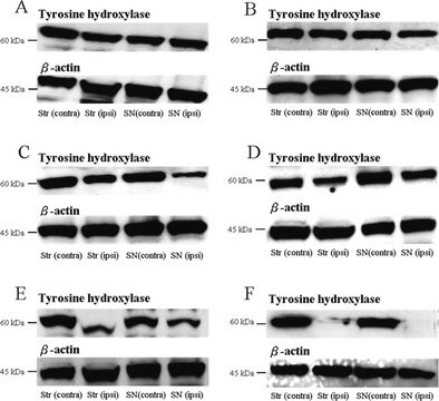 Anti-Tyrosin-Hydroxylase-Antikörper, Klon LNC1 ascites fluid, clone LNC1, Chemicon&#174;