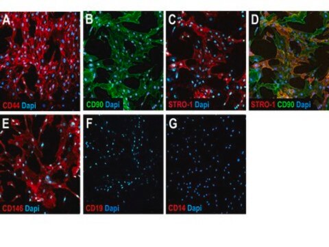 Human Mesenchymal Stem Cell Characterization Kit The Human Mesenchymal Stem Cell Characterization Kit contains a panel of positive &amp; negative selection markers for the characterization of the mesenchymal stem cell population in human samples.