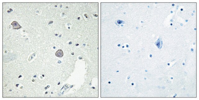 Anti-DRD1 antibody produced in rabbit affinity isolated antibody