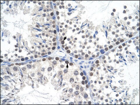 Anti-TFAM (AB3) antibody produced in rabbit affinity isolated antibody