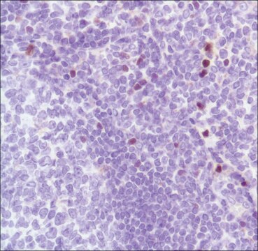 Anti-FOXP3 antibody, Rabbit monoclonal recombinant, expressed in proprietary host, clone SP97, affinity isolated antibody