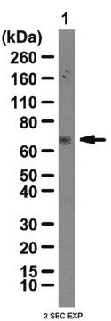 Anti-IGF2 mRNA-binding protein 3 Antibody from rabbit, purified by affinity chromatography