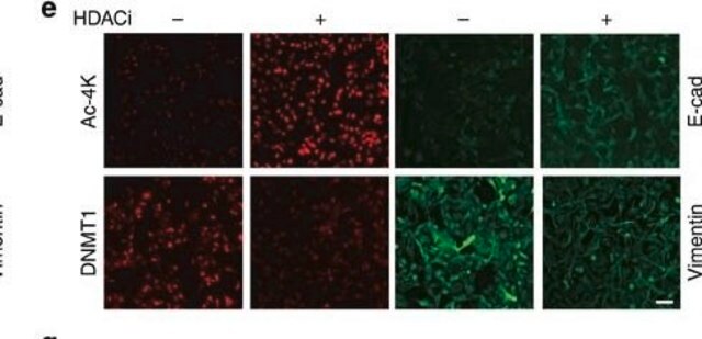 Monoklonales Anti-Vimentin in Maus hergestellte Antikörper clone V9, ascites fluid