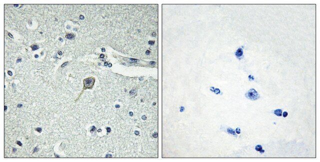 Anti-PTHR1 antibody produced in rabbit affinity isolated antibody