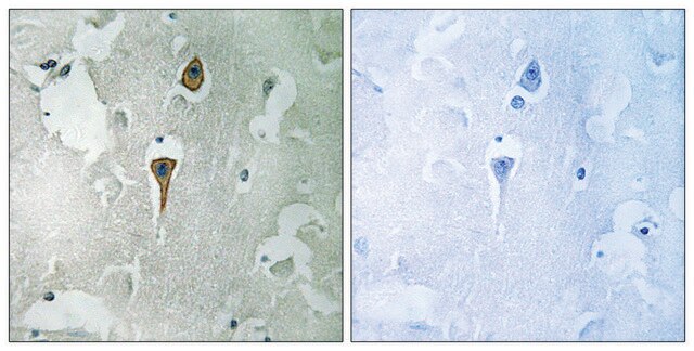 Anti-NMDAR1 antibody produced in rabbit affinity isolated antibody