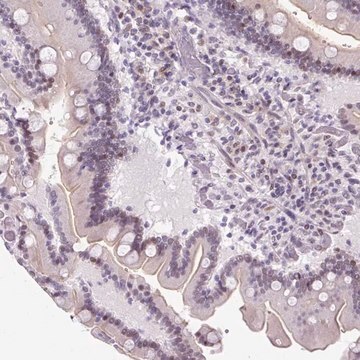 Anti-CTB-133G6.1 antibody produced in rabbit Prestige Antibodies&#174; Powered by Atlas Antibodies, affinity isolated antibody, buffered aqueous glycerol solution