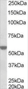 Anti-RXR &#945; antibody produced in goat affinity isolated antibody, buffered aqueous solution