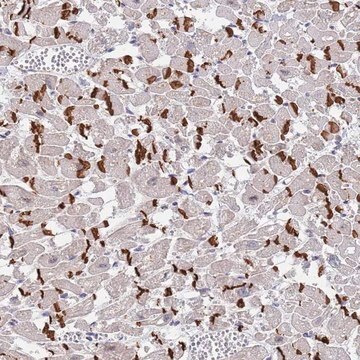 Anti-MUM1 antibody produced in rabbit Prestige Antibodies&#174; Powered by Atlas Antibodies, affinity isolated antibody, buffered aqueous glycerol solution