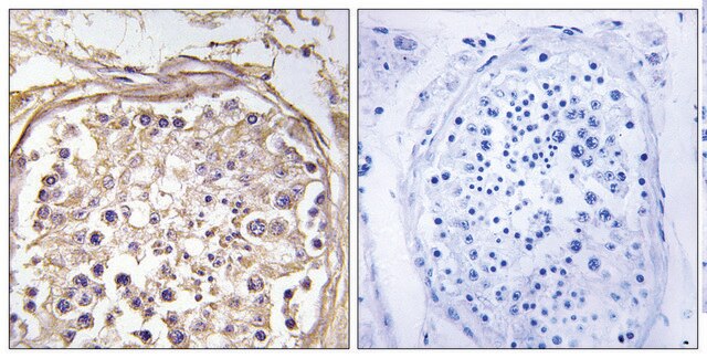 Anti-CHST9, C-Terminal antibody produced in rabbit affinity isolated antibody