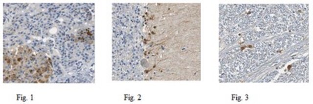 Anti-Trypsin-3 Antibody from rabbit, purified by affinity chromatography