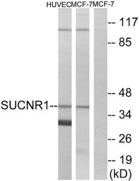 Anti-SUCNR1 antibody produced in rabbit affinity isolated antibody