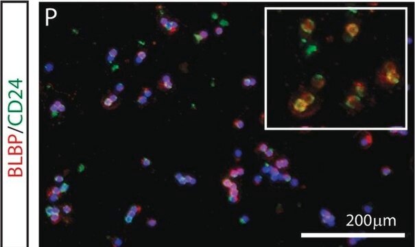 Anti-Gehirn-spezifisches Lipidbindungsprotein-Antikörper from rabbit, purified by affinity chromatography