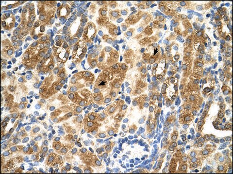 Anti-MAS1 (AB2) antibody produced in rabbit IgG fraction of antiserum