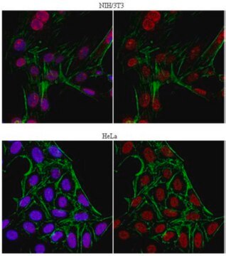 Anti-JHDM1B Antibody from rabbit, purified by affinity chromatography