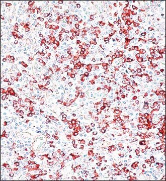 Anti-Human IgG (&#947;-chain specific)&#8722;Peroxidase antibody produced in goat IgG fraction of antiserum, buffered aqueous solution