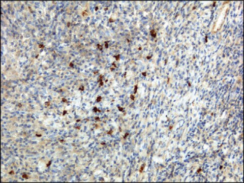 Anti-Human IgA antibody, Rabbit monoclonal recombinant, expressed in HEK 293 cells, clone RM128, purified immunoglobulin