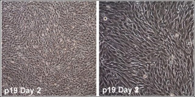 O9-1 Mouse Cranial Neural Crest Cell Line The O9-1 cell line stably expresses stem cell markers (CD44, Sca-1, and Bmi1) and neural crest markers (AP-2a, Twist1, Sox9, Myc, Ets1, Dlx1, Dlx2, Crabp1, Epha2, and Itgb1). O9-1 cells are capable of contributing to cranial mesenchymal (osteoblast and smooth muscle) neural crest fates.