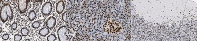 Anti-PTEN-alpha Antibody, clone 3A4.1 clone 3A4.1, from mouse