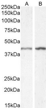 Anti-Smooth Muscle &#945;-Actin antibody produced in goat affinity isolated antibody, buffered aqueous solution