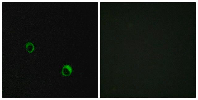 Anti-CAR14 antibody produced in rabbit affinity isolated antibody