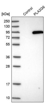 Anti-PLA2G6 antibody produced in rabbit Prestige Antibodies&#174; Powered by Atlas Antibodies, affinity isolated antibody, buffered aqueous glycerol solution