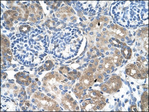 Anti-SLC38A4 antibody produced in rabbit IgG fraction of antiserum