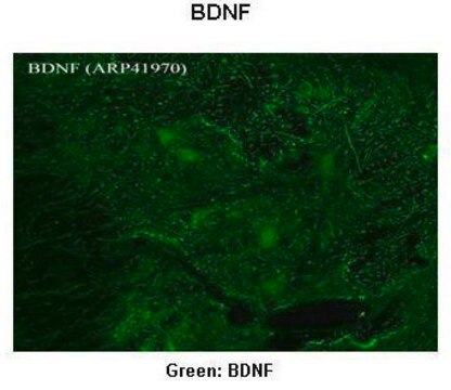 Anti-BDNF antibody produced in rabbit