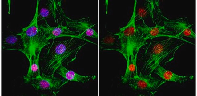 Anti-MDC1 Antibody, clone P2B11 clone P2B11, from mouse