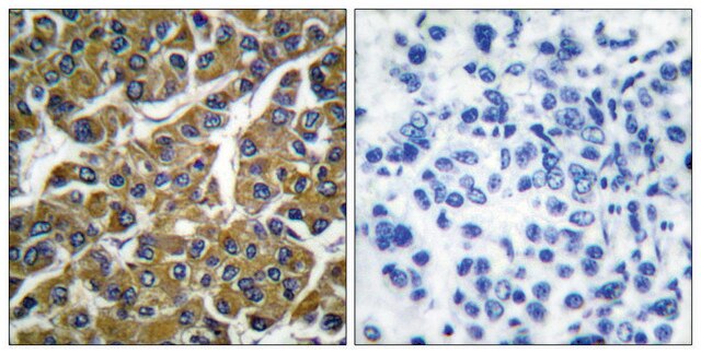 Anti-MMP-3 antibody produced in rabbit affinity isolated antibody