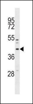 ANTI-MFF (CENTER) antibody produced in rabbit affinity isolated antibody, buffered aqueous solution