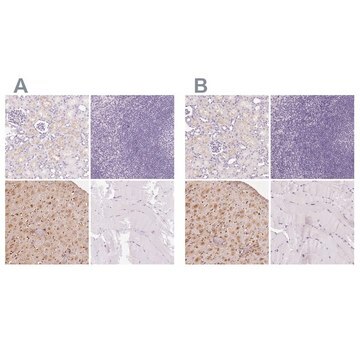 Anti-IGFBP1 antibody produced in rabbit Prestige Antibodies&#174; Powered by Atlas Antibodies, affinity isolated antibody, buffered aqueous glycerol solution