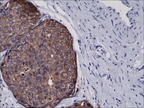 Anti-HER2 antibody, Rabbit monoclonal recombinant, expressed in HEK 293 cells, clone RM228, purified immunoglobulin