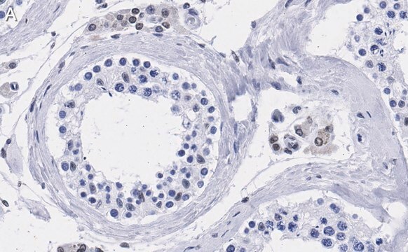 Anti-TFE3 Antibody, clone 1G5 ZooMAb&#174; Rabbit Monoclonal recombinant, expressed in HEK 293 cells