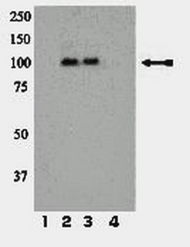 Anti-Phospho-IR/IGF1R (Tyr1158/Tyr1162/Tyr1163)-Antikörper Upstate&#174;, from rabbit