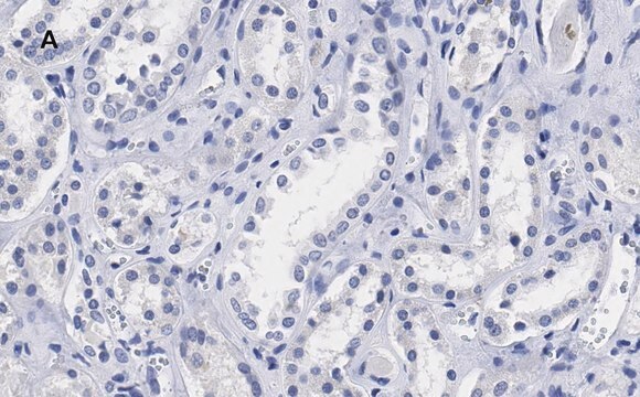 Anti-Lamin B1 Antibody, clone 6K22, ZooMAb&#174; Rabbit Monoclonal recombinant, expressed in HEK 293 cells