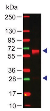 Anti-Human IgA (&#945;-chain specific) antibody produced in rabbit affinity isolated antibody, buffered aqueous solution