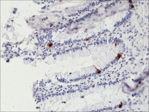 Anti-Chromogranin A antibody, Rabbit monoclonal recombinant, expressed in HEK 293 cells, clone RM385, purified immunoglobulin