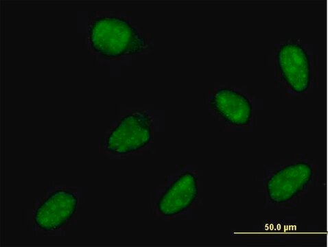 ANTI-ATOH1 antibody produced in mouse clone 3E2, purified immunoglobulin, buffered aqueous solution