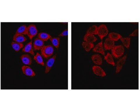 Anti-SMN Antibody, clone 62E7 clone 62E7, from mouse