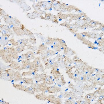 Anti-PPAR gamma antibody produced in rabbit