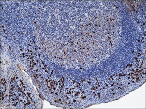 Anti-Human IgA1 antibody, Rabbit monoclonal recombinant, expressed in HEK 293 cells, clone RM124, purified immunoglobulin