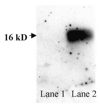 Anti-Superoxide Dismutase 1 Antibody, aa 25-37 serum, Chemicon&#174;