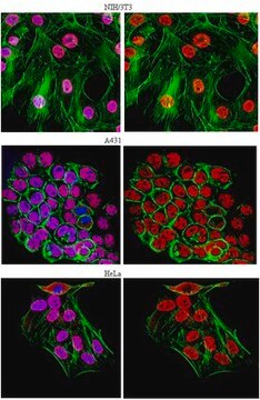 Anti-U1-70K Antibody, clone 9C4.1 clone 9C4.1, from mouse