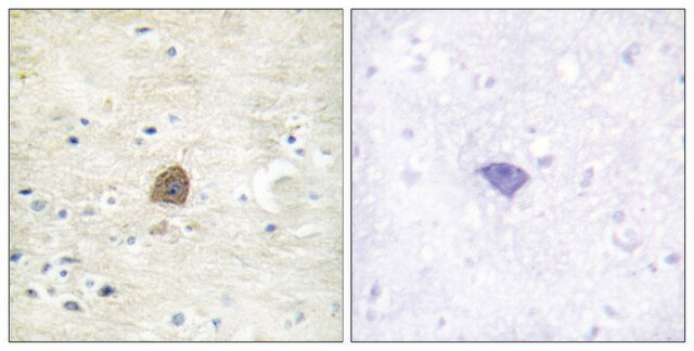 Anti-phospho-CaMK2&#945;/&#946;/&#948; (pThr305) antibody produced in rabbit affinity isolated antibody