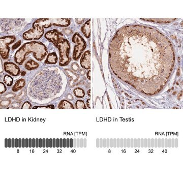 Anti-LDHD antibody produced in rabbit Prestige Antibodies&#174; Powered by Atlas Antibodies, affinity isolated antibody, buffered aqueous glycerol solution