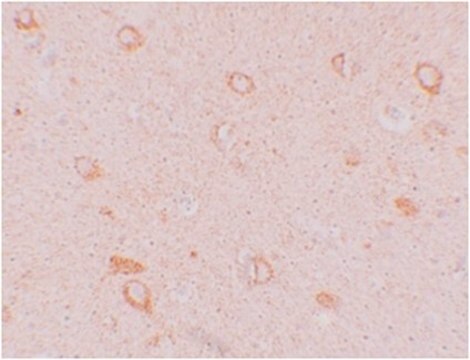 Anti-CIITA Antibody from rabbit, purified by affinity chromatography