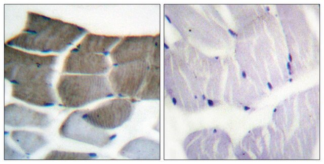 Anti-ACC1 antibody produced in rabbit affinity isolated antibody